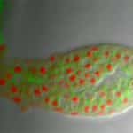Myxozoa: Tiny Cnidarian Parasites of Fish and Invertebrates