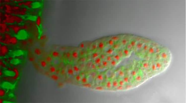 Myxozoa: Tiny Cnidarian Parasites of Fish and Invertebrates