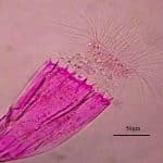 Phylum Cephalorhyncha: Tiny Marine Worms
