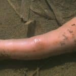 Spoon Worms: The Wonders Of Subclass Echiuroidea (Phylum Echiura)
