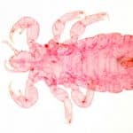 Psocodea: Anoplura: The Clingy World Of Sucking Lice