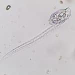 Larvacea: Planktonic, House-Dwelling Wonders Of Nature